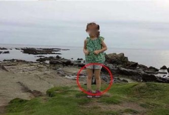 ΣΟΚαρίστηκε!! Σταμάτησε να βγάζει φωτογραφία την κόρη του όταν είδε αυτό στα πόδια της!