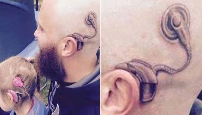 Πατέρας έκανε τατουάζ το κοχλιακό εμφύτευμα της κόρης του για να δείξει την υποστήριξή του